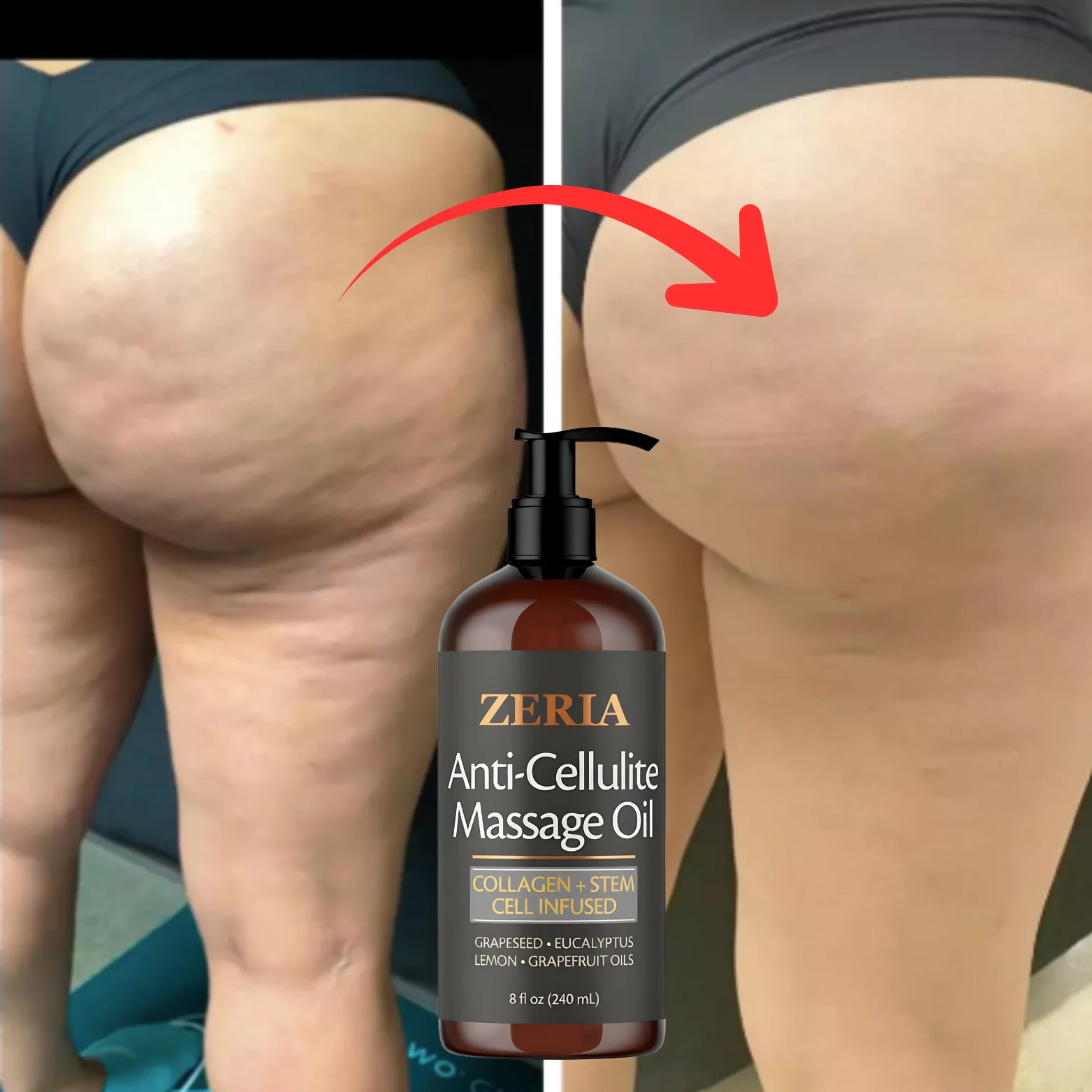 Cellulite Massage Oil. - Image 2